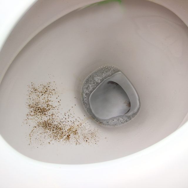 Black Spots In Toilet Bowl